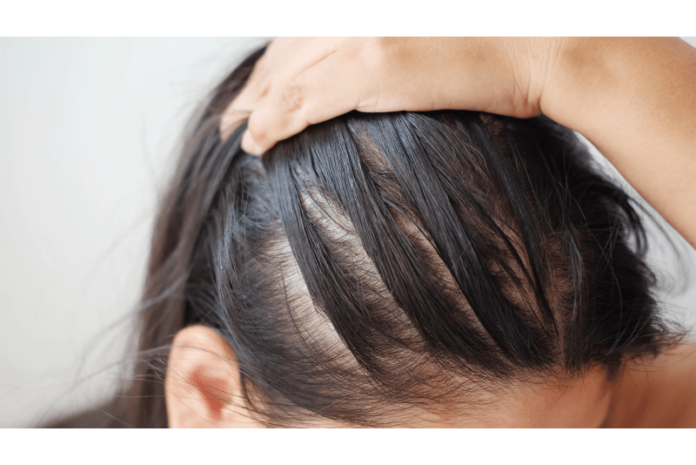 اشتباهات رایجی که باعث ریزش مو هایتان میشود
