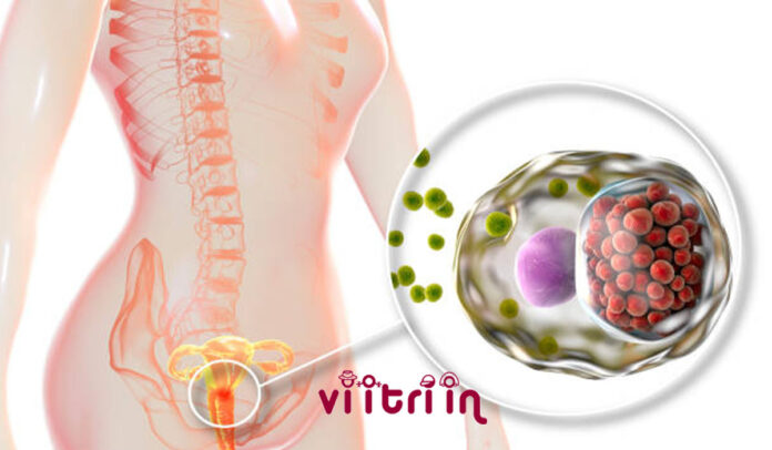 Vaginal Infection عفونت واژن و راهکارهای درمان آن