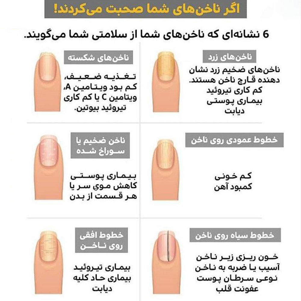 بیماری های ناخن